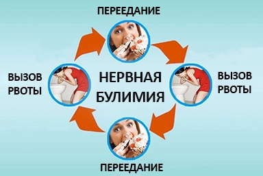 Лечение булимии в Красной Яруге